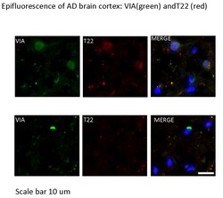MilliporeSigma A -42, oligomeric (VIA), Rabbit, Unlabeled, Polyclonal,